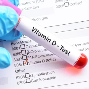 25-Hydroxy Vitamin D3 at Test Zone Diagnostic Center