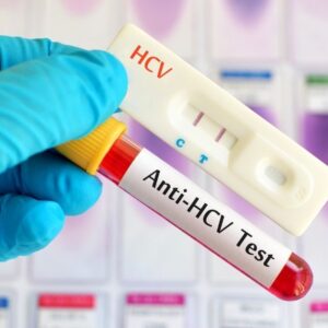 Anti-HCV at Chughtai Lab