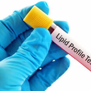 Lipid Profile at Chughtai Lab
