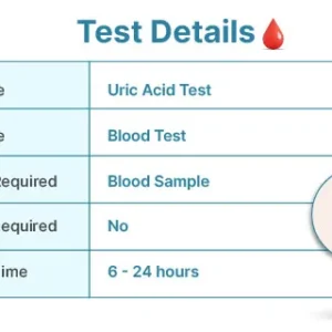 Uric Acid (Serum) at Chughtai Lab