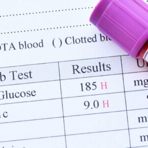 HbA1c at Test Zone Diagnostic Center