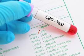 Complete Blood Count (CBC) (Blood Test) at Chughtai Lab