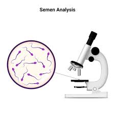 Semen Analysis at Chughtai Lab