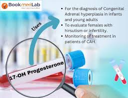 17-OH Progesterone at Chughtai Lab