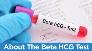 Beta hCG at Chughtai Lab
