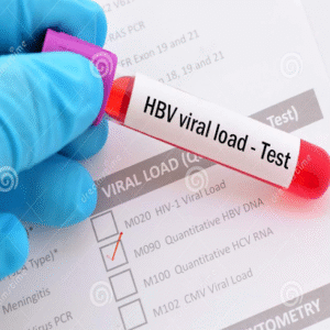 HBV PCR (Viral Load / Quantitation) at Test Zone Diagnostic Center